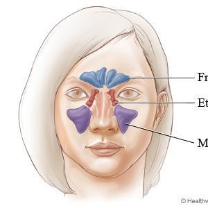 Treatments For Dry Sinuses 