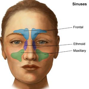 Solve Sinus Problems 