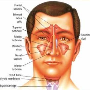 Sinusitis Sphenoid Ears - Look For The Symptoms Of Sinus Infections