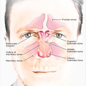 What Are The Three Ingredients For Sinus Cure 