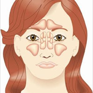 Stuffy Sinus High Blood Pressure - How Important Is Chronic Sinusitis Treatment?