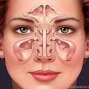 Swollen Sinuses - Cleanse Your Own Sinuses By Means Of Sinus Irrigation