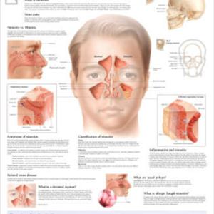 Swollen Nostril Symptom Of Sinus Infection Natural Remedy 